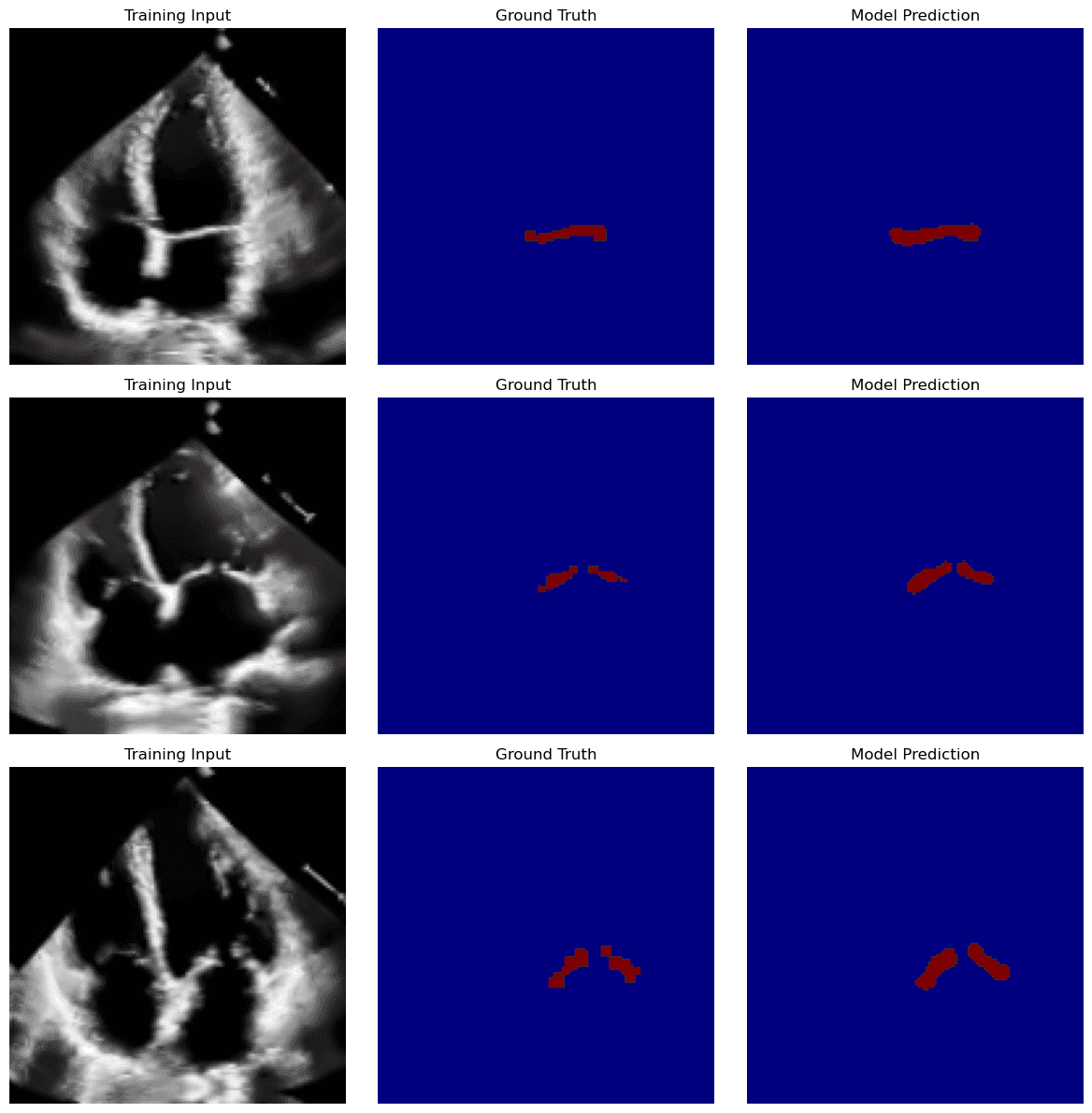 Mitral Valve Segmentation evidence 2